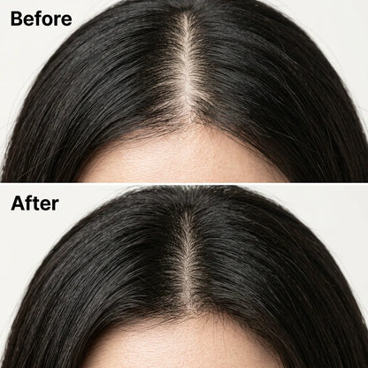 HairBloom™ - Geef dunner wordend haar nieuw leven