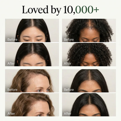 HairBloom™ - Geef dunner wordend haar nieuw leven