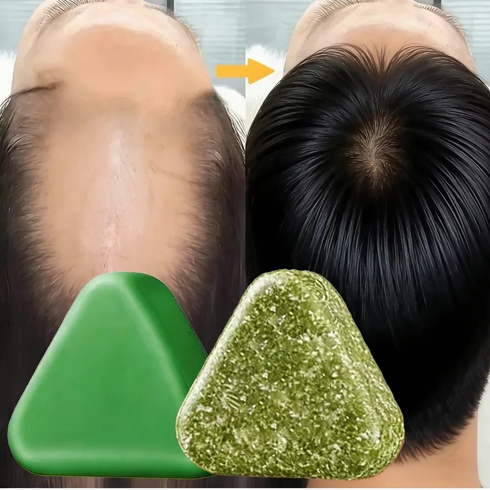 HairBloom™ - Geef dunner wordend haar nieuw leven